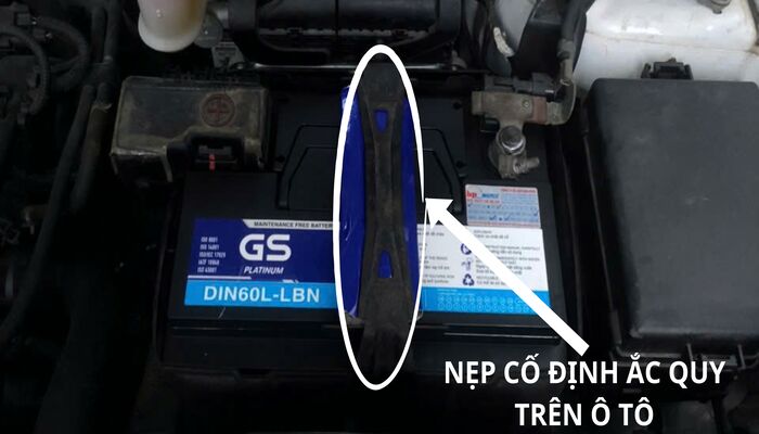 Hình ảnh nẹp cố định ắc quy ô tô